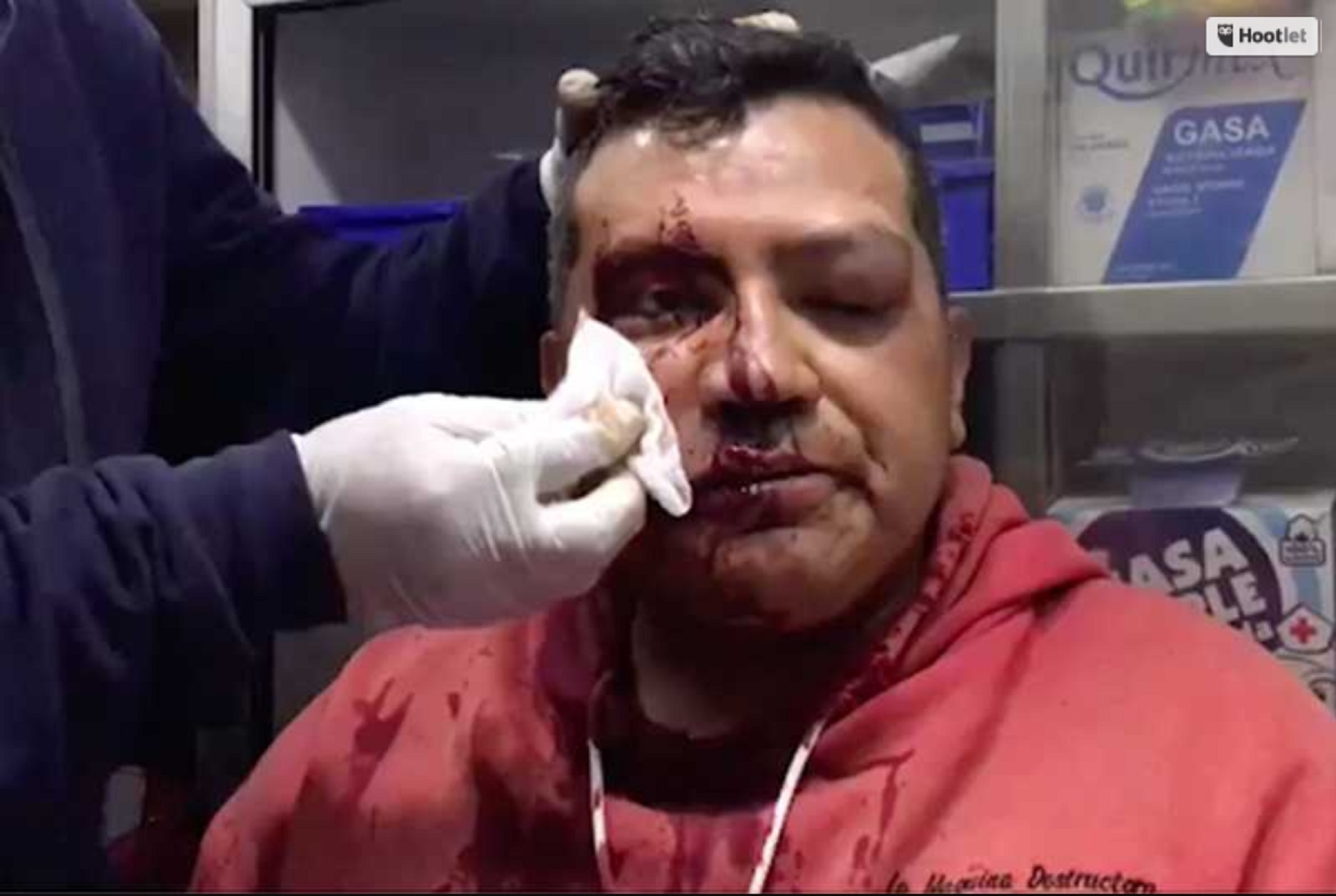 Foto: periodista golpeado en la Doctores. (Tomada del video: Cortesía Isidro Corro