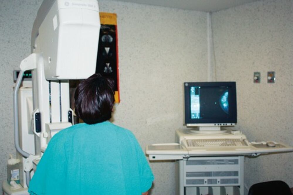 Ven reducción en mortalidad causada por  cáncer de mama
