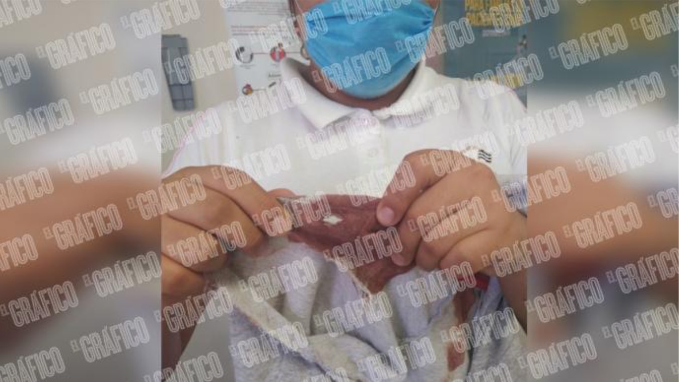 Menor de cinco años se da un balazo con pistola de su tía Dulce, en Iztapalapa