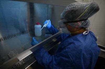 Reforzarán Médico en tu Casa para más pruebas