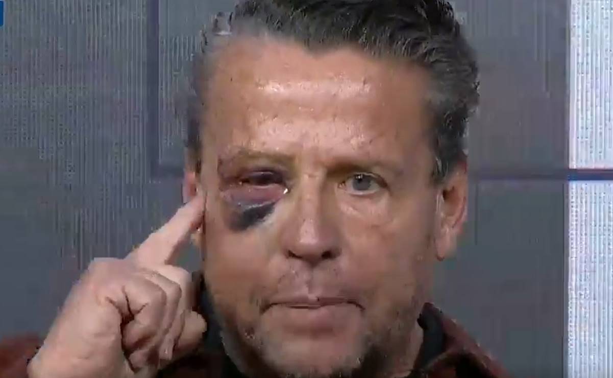 Alfredo Adame asegura que su ojo podría quedar inservible