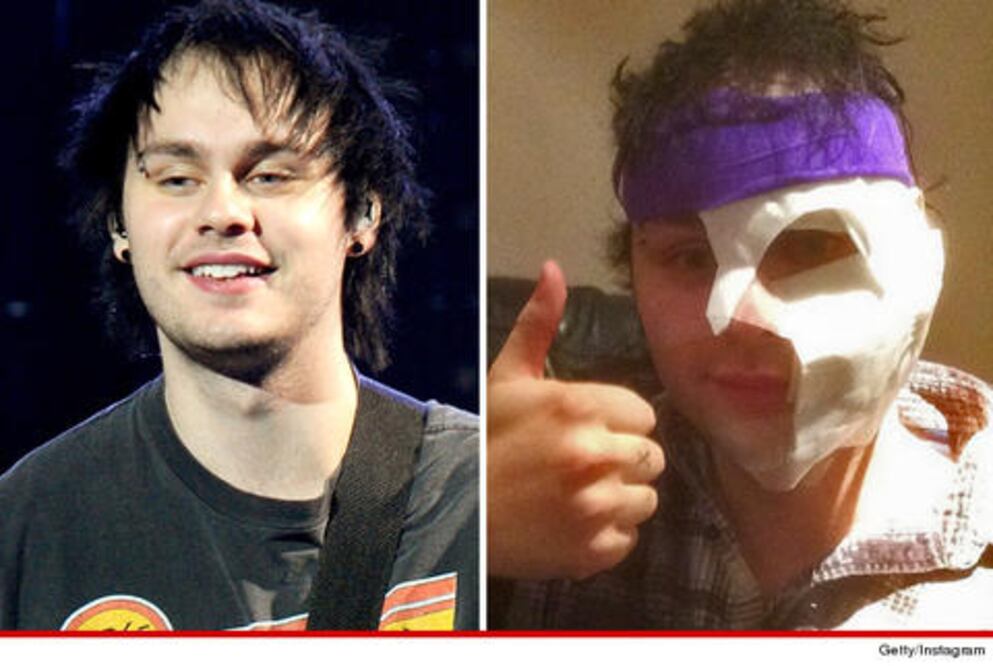 Guitarrista se quema la cara