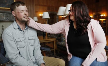 Mujer se encuentra con hombre que recibió el rostro de su marido