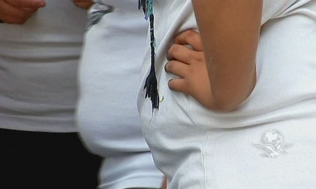 Desnutrición versus obesidad