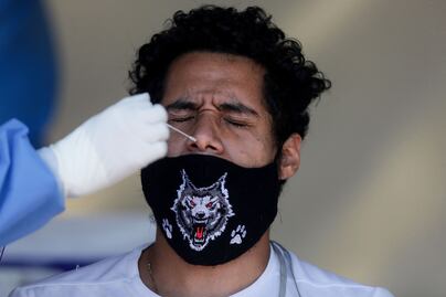 Crecen las muertes por Covid-19 en la población de 20 a 49 años