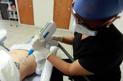 El 70% borra tatuajes por ruptura amorosa