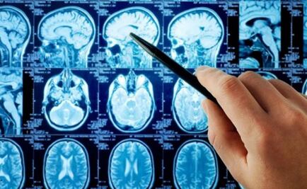 "Ameba come cerebros" mata a niño en Argentina; es el primer caso