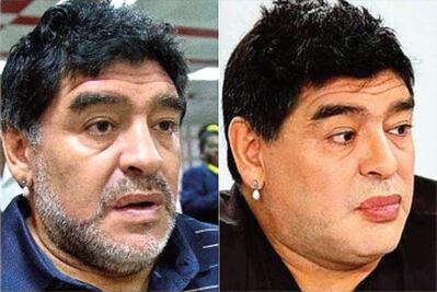 Critican a Maradona en todo el mundo por su operación de rostro