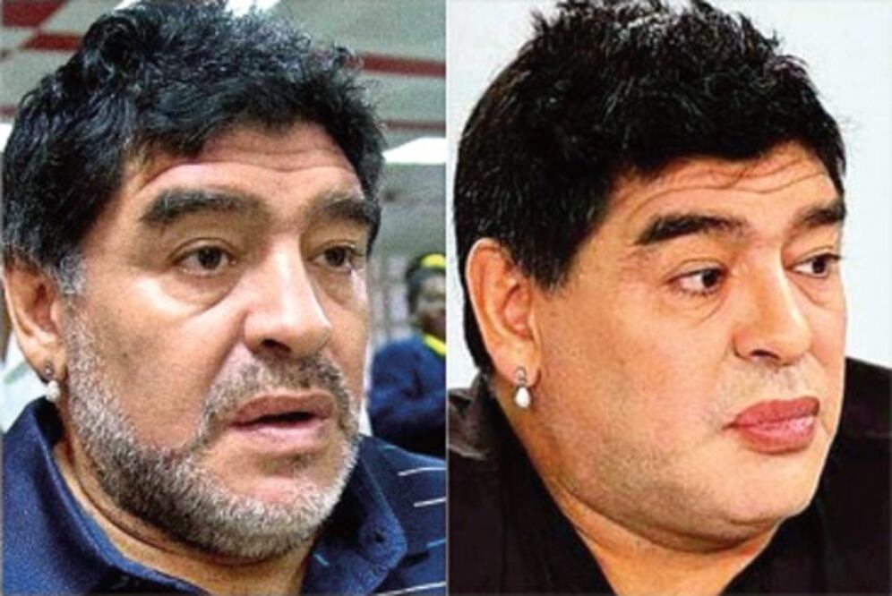 Critican a Maradona en todo el mundo por su operación de rostro