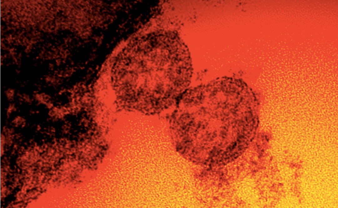 Mutación E484K del coronavirus es detectada en México