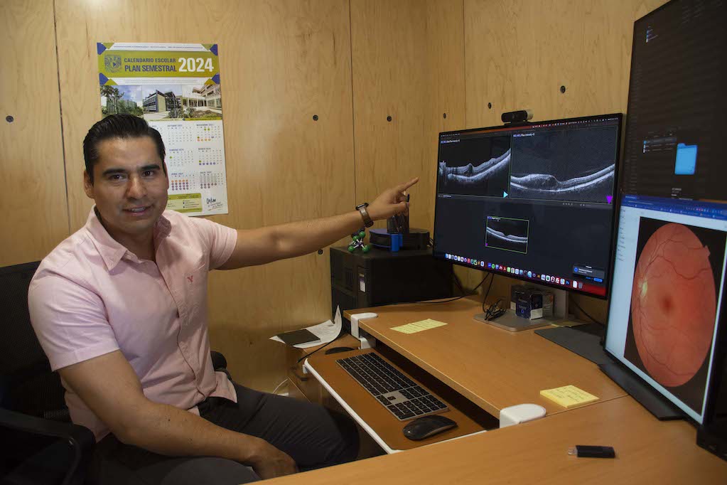 En la UNAM Juriquilla, trabajan con IA para identificar edema macular diabético