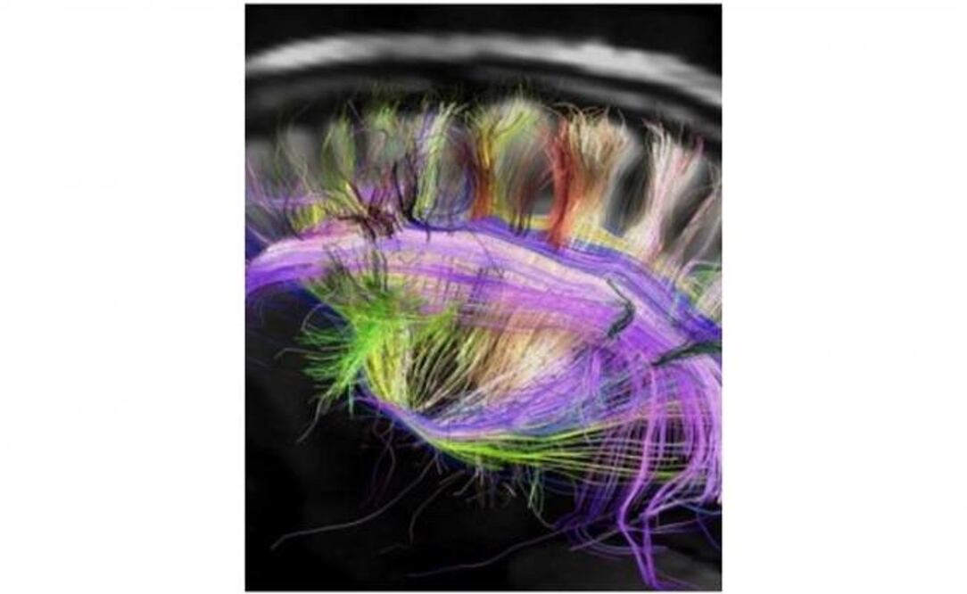 Los científicos extrajeron el ARN del sistema nervioso de los caracoles marinos que recibieron los choques. / Foto: Archivo