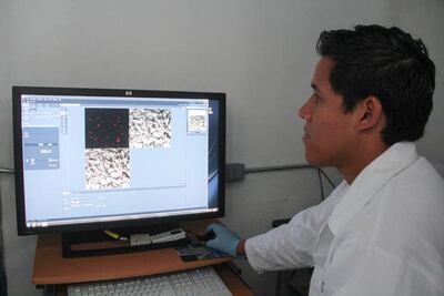 Trabajan con valeriana para mal de parkinson