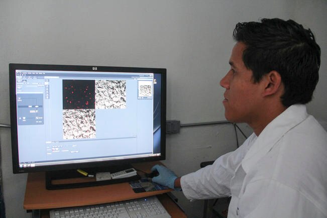 Trabajan con valeriana para mal de parkinson