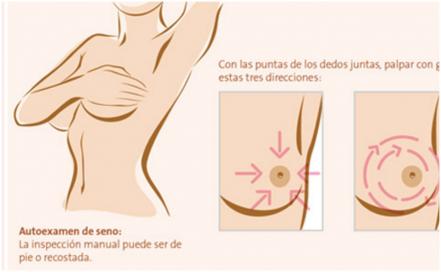 Te decimos cómo hacer un autoexamen mamario y prevenir el cáncer de mama