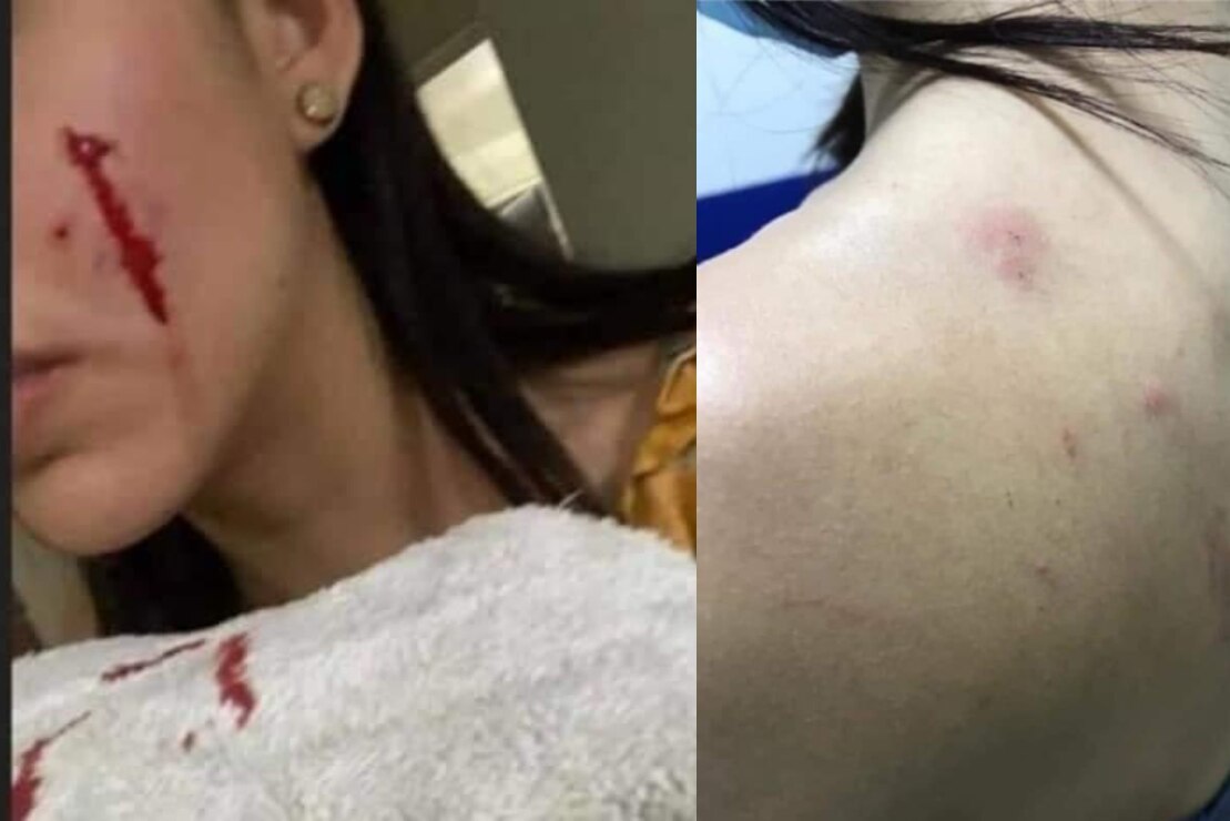 “Rodolfo Corazón” mordió primero, dice novia de joven que mató a perrito con hacha