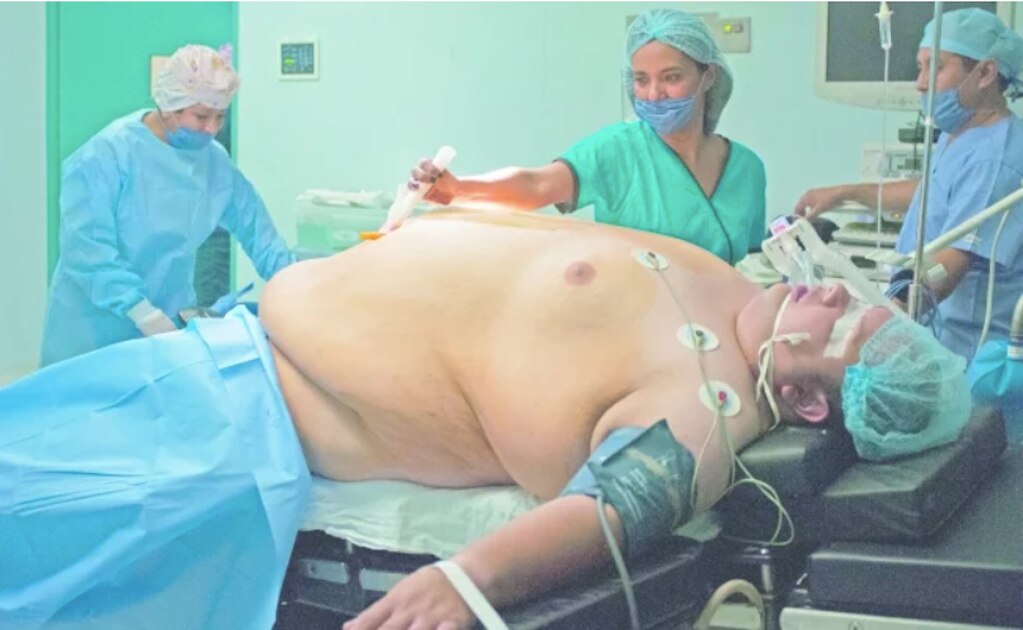 Súper obesidad gana terreno en México