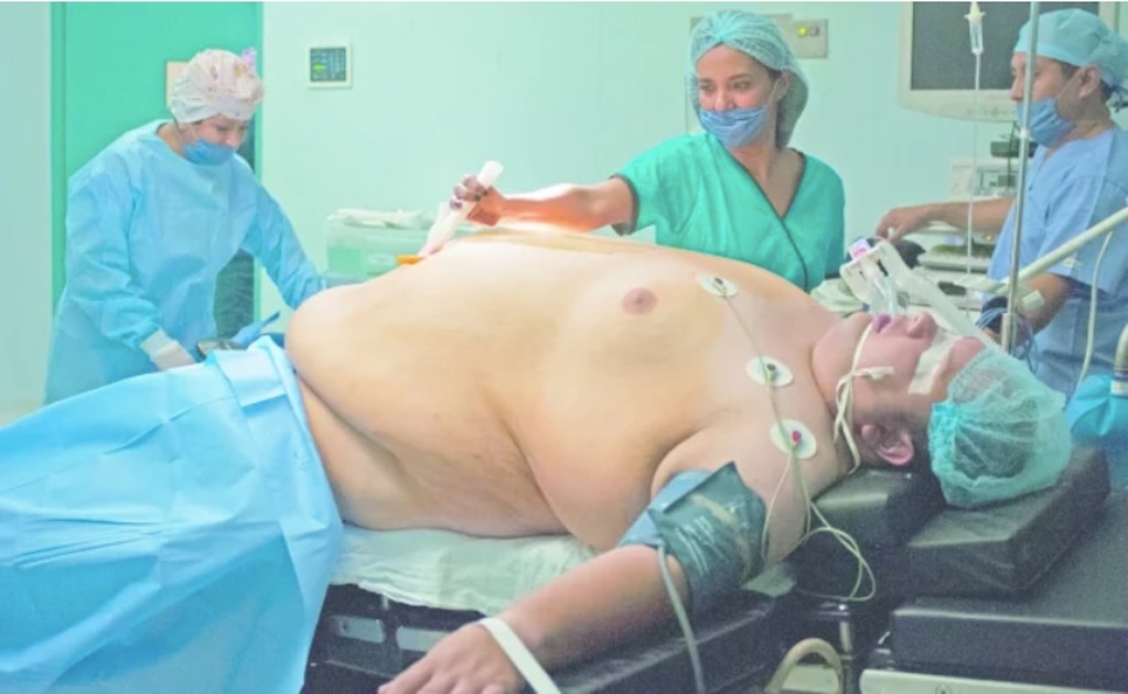 Jorge Gómez, un paciente con súper obesidad u obesidad mórbida, es operado en el Hospital General Dr. Rubén Leñero de la Ciudad de México. FOTOS: IVÁN STEPHENS/El Universal