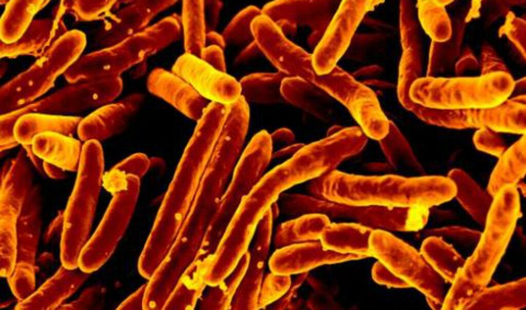Llaman a crear conciencia sobre la tuberculosis