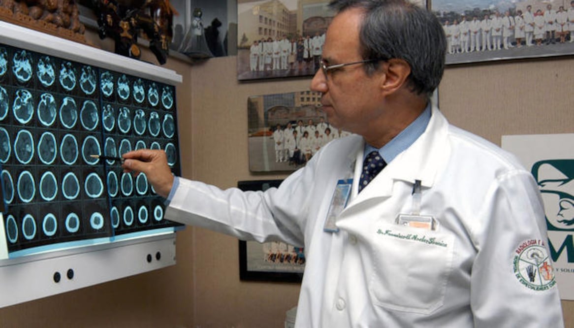 Aproximadamente 80% de las personas con Parkinson presentan algún tipo de temblor en una de las extremidades / FOTO: ARCHIVO EL UNIVERSAL