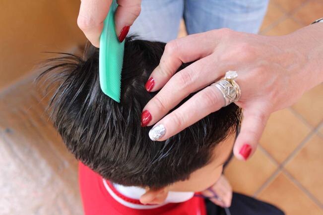 Van 477 casos de piojos en Querétaro: Seseq