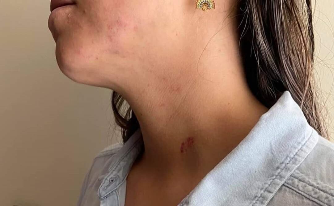 Mujer embarazada pide justicia tras sufrir golpiza por sobrino de candidata de Tlaxcala