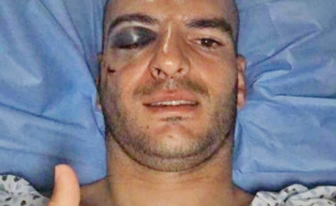 “Fue un golpe, pero de suerte”
