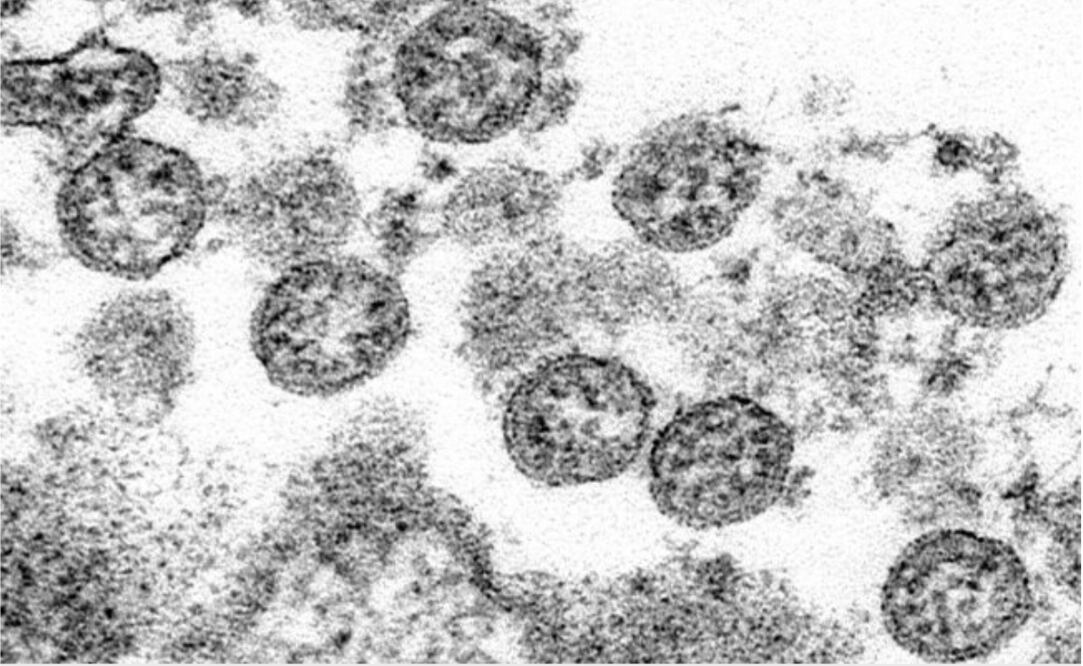 C.S. Goldsmith, A. Tamin/CDC via AP