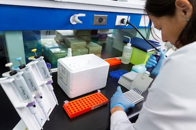 UAQ busca fondos para hacer pruebas