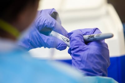 Suman 1,200 casos positivos de influenza