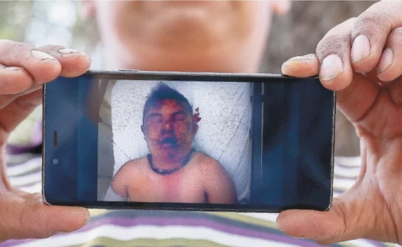“Ocho personas me golpearon... me llamaban ladrón”, dice joven linchado