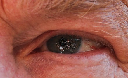 Descubren anomalías en ojos de pacientes graves de covid-19