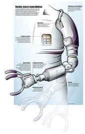 Protesis inteligentes