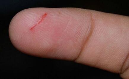 ¿Por qué cortarse con un papel es tan doloroso?