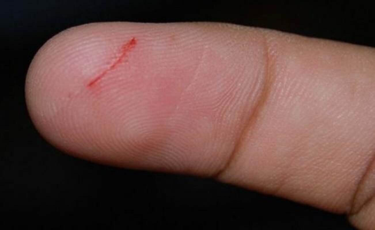 ¿Por qué cortarse con un papel es tan doloroso?