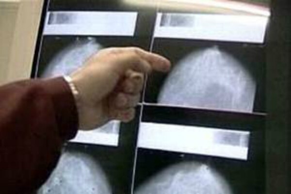 Jornada contra cáncer de mama en Tequisquiapan