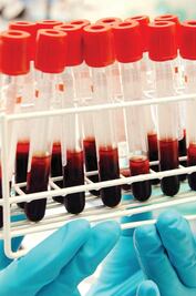 Laboratorio de Conade, certificado por la WADA