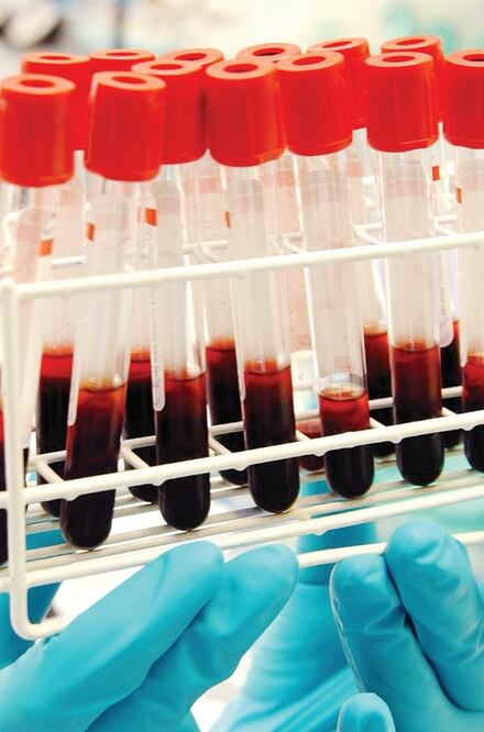 Laboratorio de Conade, certificado por la WADA