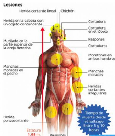 Abandonan cadáver embolsado en la GAM; restos presentaban signos de tortura