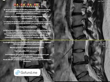 Piden apoyo para cirugía urgente de Zayra, joven con hernia lumbar