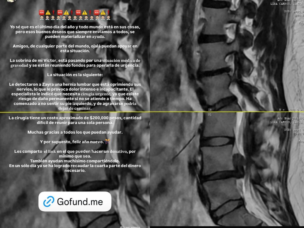 FOTO. CAPTURA DE PANTALLA