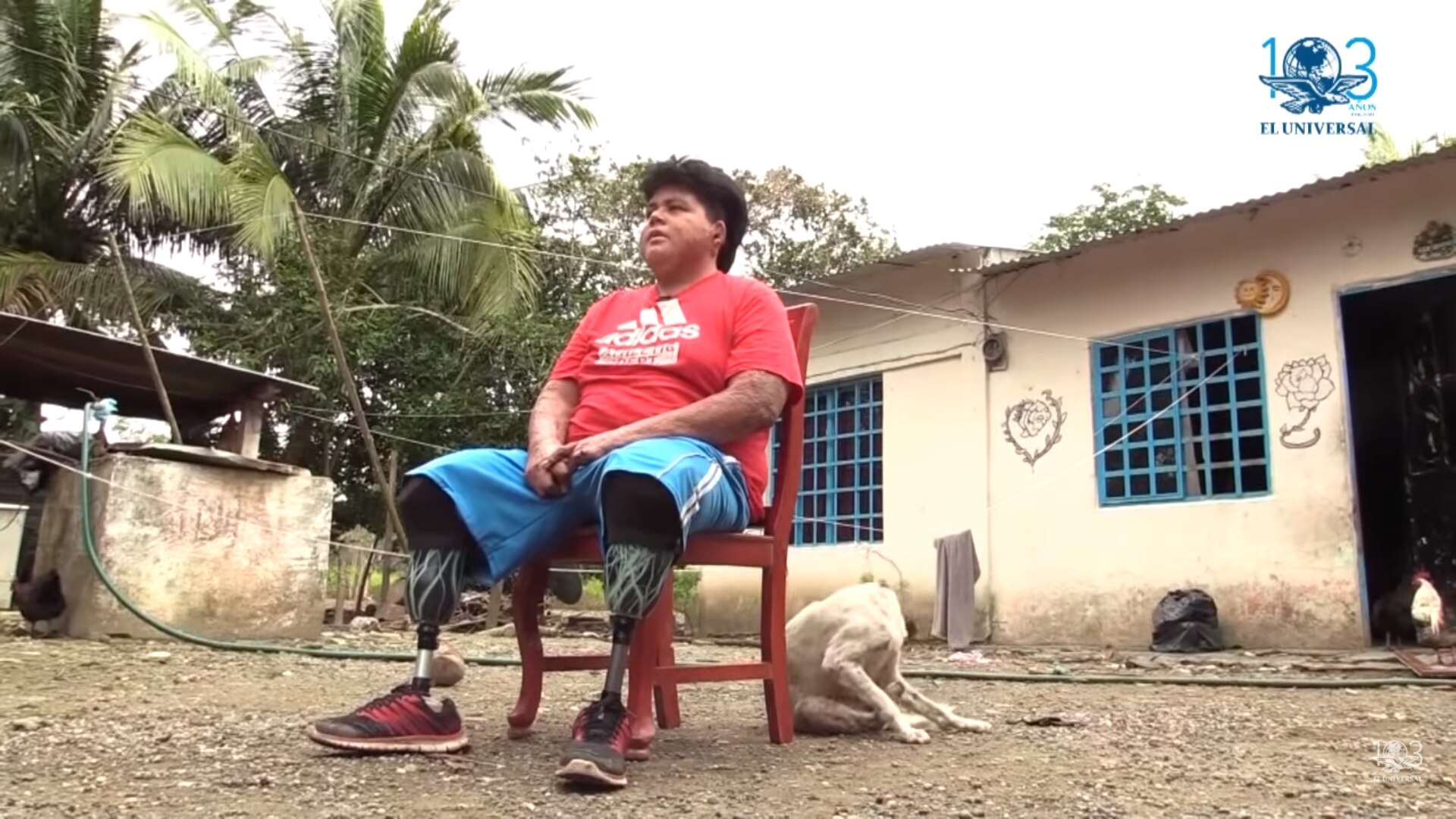 A casi cuatro años de sufrir quemaduras en 80% de su cuerpo, Juan José pide a las personas pensar en sus vidas antes de sustraer gasolina de una toma clandestina. Fotos: LUMA LÓPEZ