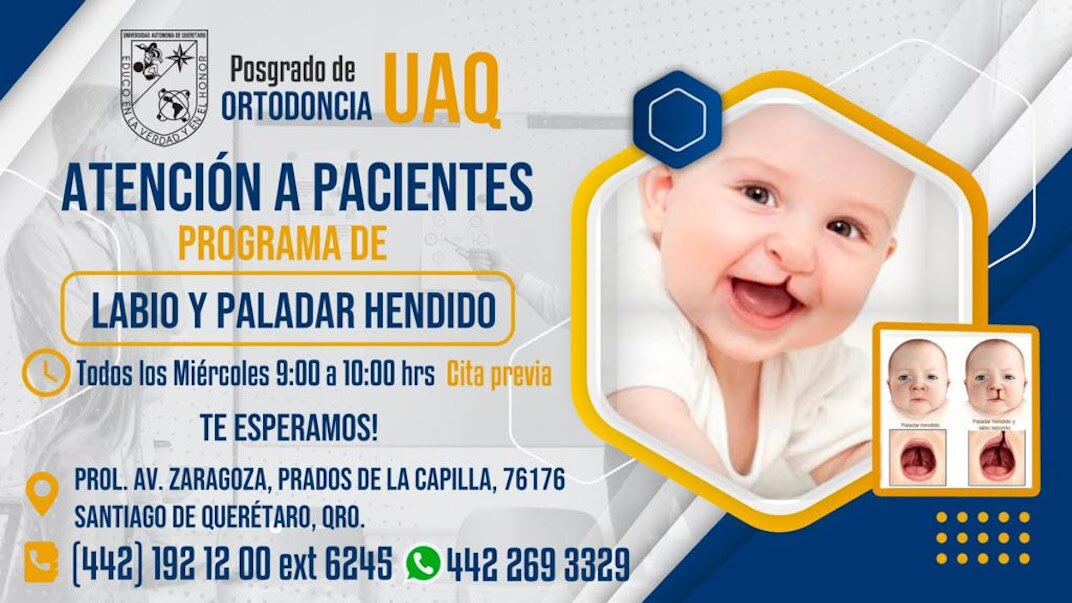 UAQ tratará a menores con paladar hendido
