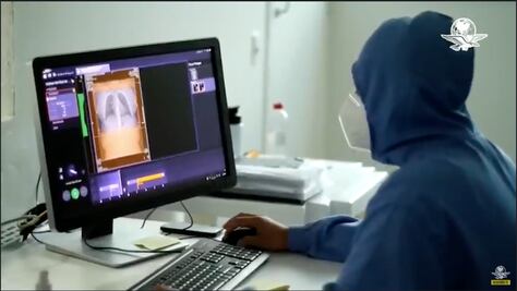 Bajan nuevos casos y muertes por Covid-19 en el mundo, según la OMS