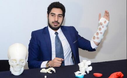 Ingeniero de la UNAM donará prótesis a afectados por sismos