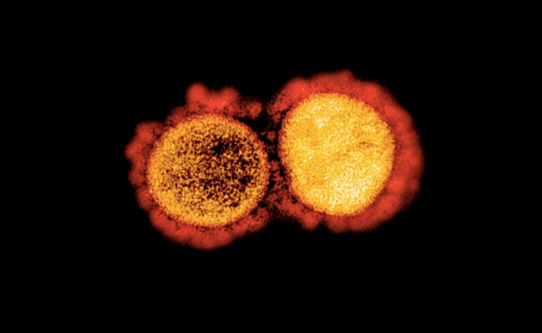 Descubren una forma de debilitar la infección del coronavirus