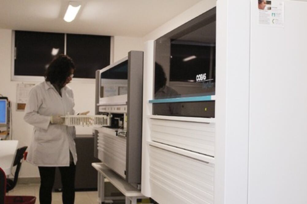 Avanza detección de VIH