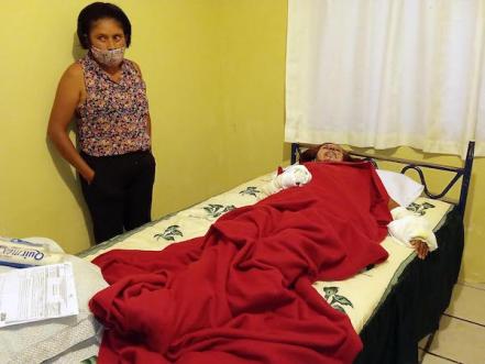 Olivia, mujer quemada con aceite y ácido, quiere que su agresor vea las consecuencias