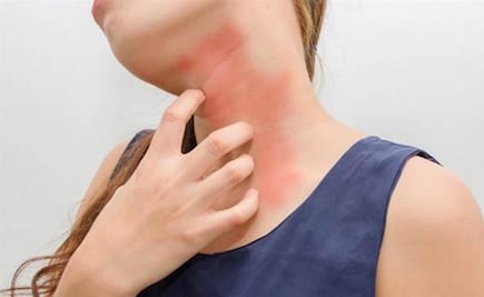 Depresión y ansiedad agravan procesos alérgicos, advierte especialista