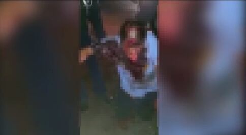 Dos perros "canario corso" atacan a un hombre en Querétaro; lo dejan gravemente herido